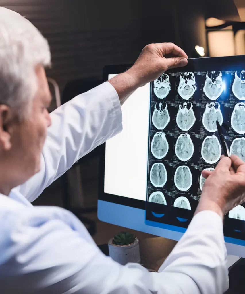 Arzt analysiert Gehirn-Scans am Computer-Monitor - moderne Demenz-Diagnostik und Früherkennung