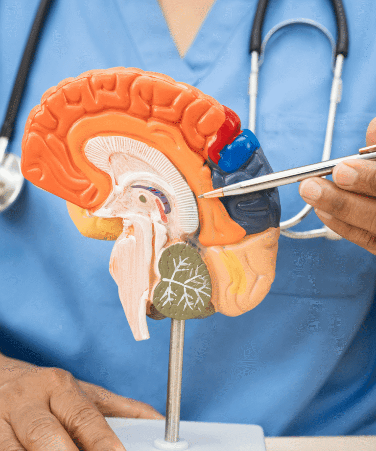 Mediziner zeigt Gehirnmodell – Demenz-Aufklärung und neurologische Erklärung für Angehörige